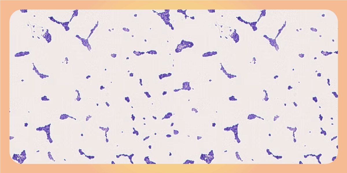 Çfarë janë probiotikët dhe prebiotikët. Një shpjegim